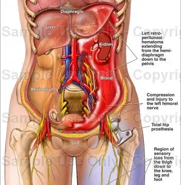Retroperiton Nedir? Retroperitoneal Organlar ve Hastalıklar