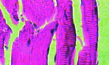 Çizgili Kas (İskelet Kası) Nedir? Yapısı, Özellikleri ve Görevleri