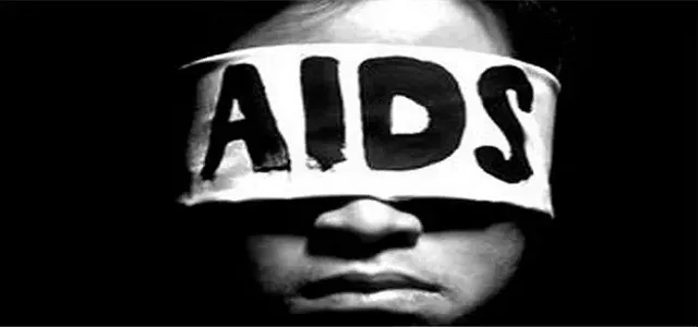AIDS Belirtileri, AIDS Tedavisi ve AIDS’ den Korunma
